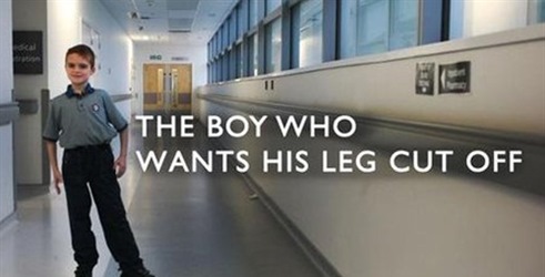 Dečak koji hoće da mu odseku nogu