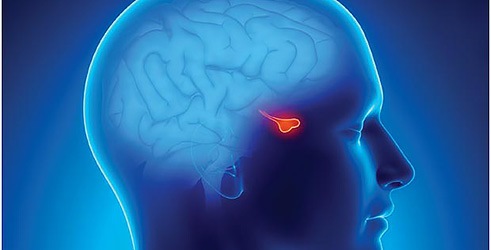 Tumor hipofize