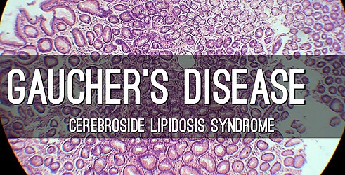 Gaucherova bolest: Tajanstveni genetski poremećaj