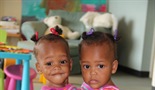 Dominikanski sijamski blizanci