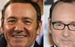Kako se Kevin Spacey bori protiv ćelavosti?