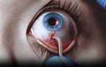 The Strain